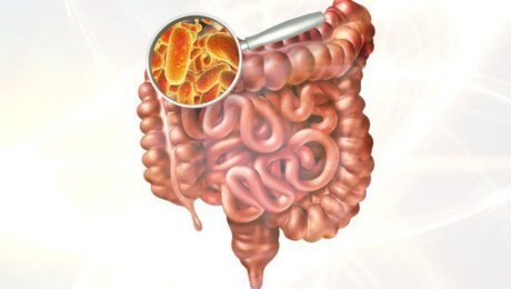 DISBIOSE INTESTINAL