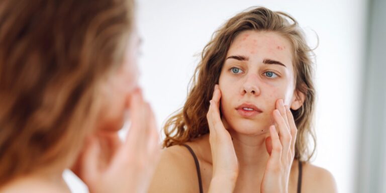 Cortisol e pele: como o estresse impacta a barreira cutânea